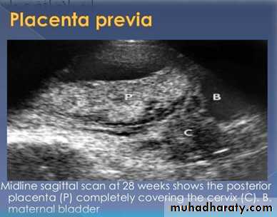 Ultrasound in Obestatric