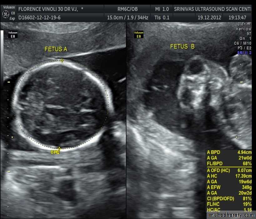 Ultrasound in Obestatric