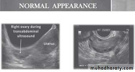 Ultrasound in Obestatric
