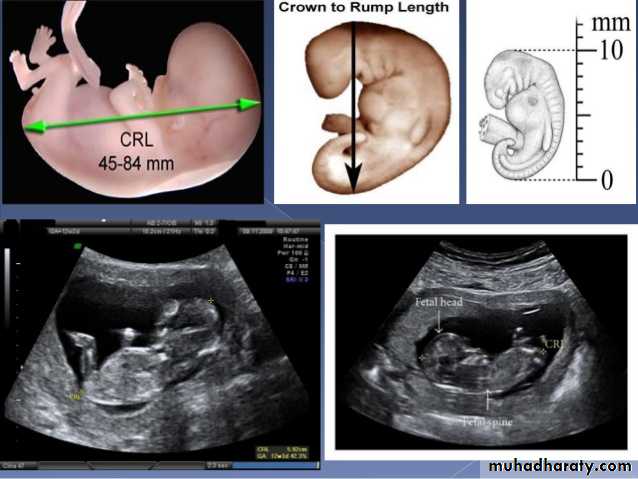 Ultrasound in Obestatric