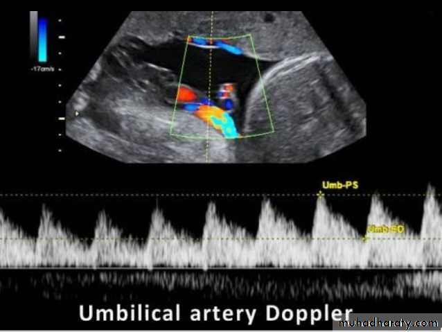 Ultrasound in Obestatric