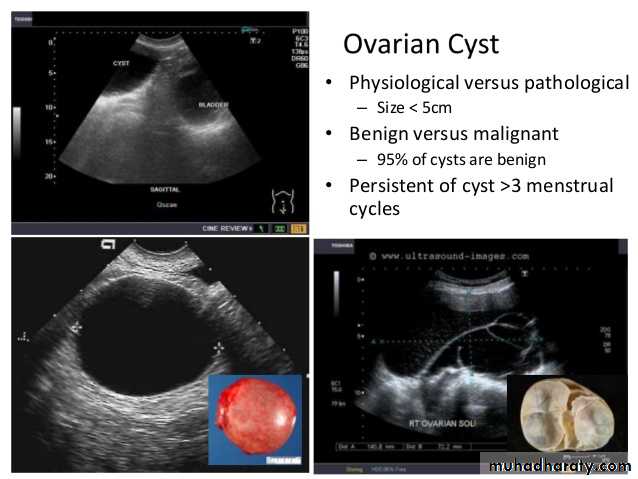 Ultrasound in Obestatric