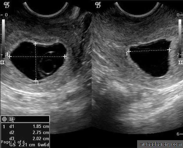 Ultrasound in Obestatric