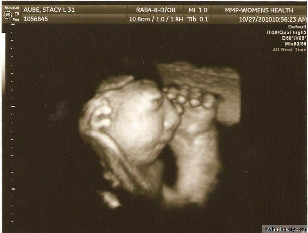 Ultrasound in Obestatric