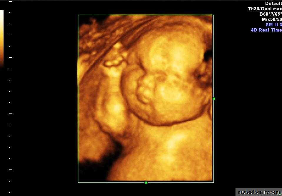 Ultrasound in Obestatric