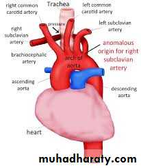 Internal Carotid Artery