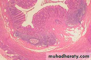 General histo theory