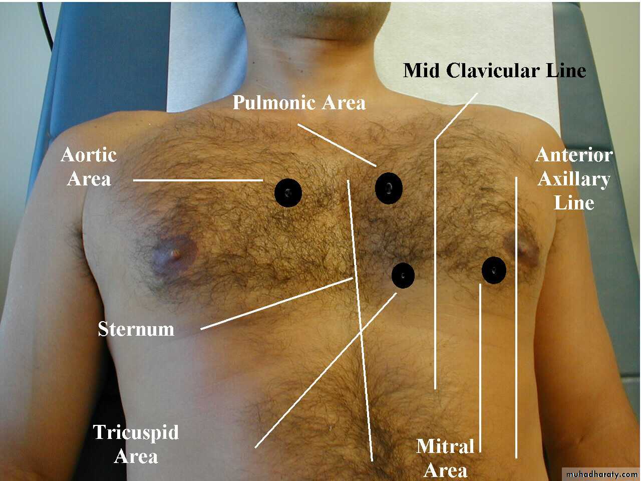 chest examination