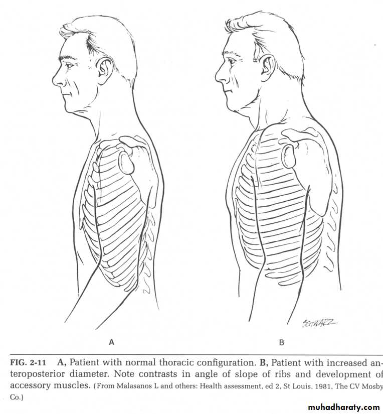 chest examination