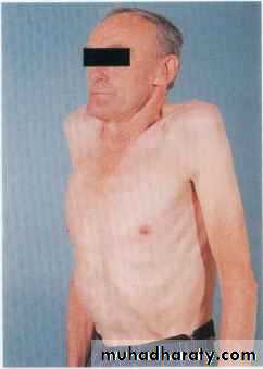 chest examination