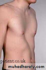 chest examination