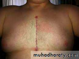 chest examination