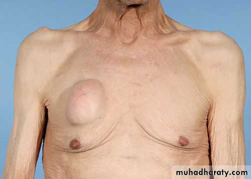 chest examination