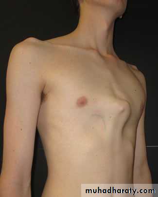 chest examination