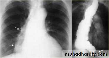 GIT