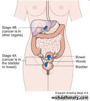 malignant uterus