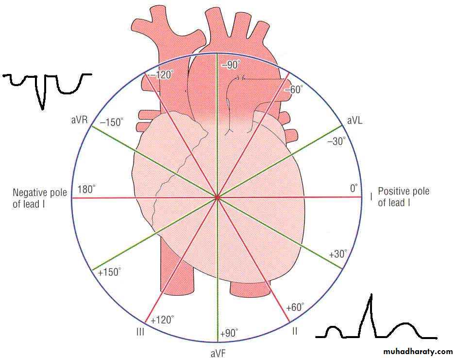ECG