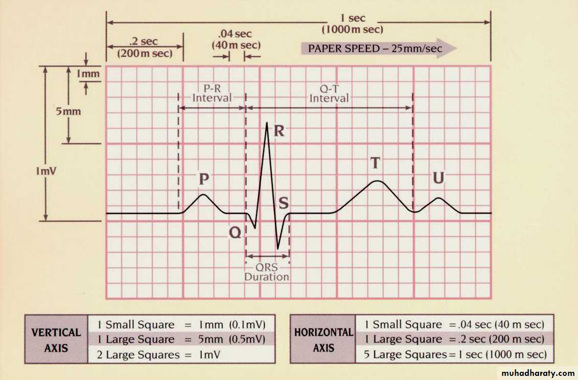 ECG