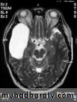 MRI