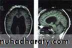 MRI