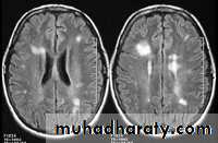 MRI
