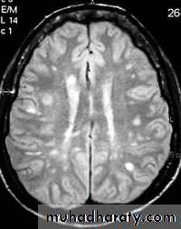 MRI