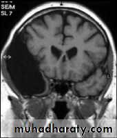 MRI