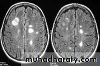 MRI