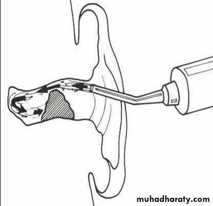 ear