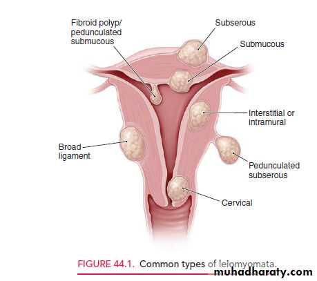 begnin uterus