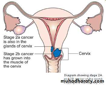 malignant uterus