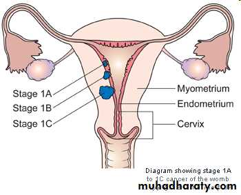 malignant uterus