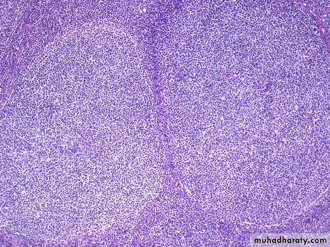 Lymph Node