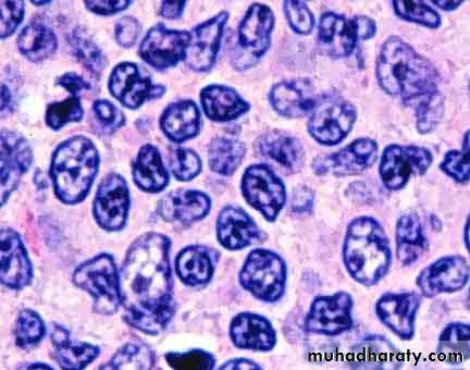 Lymph Node