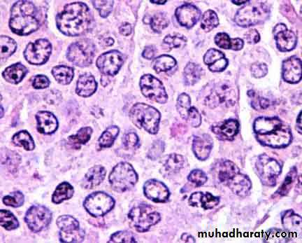 Lymph Node