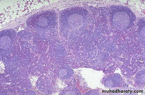 Lymph Node
