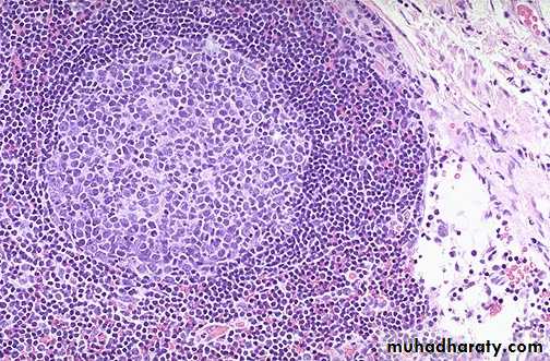 Lymph Node