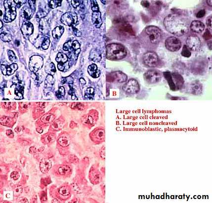 Lymph Node