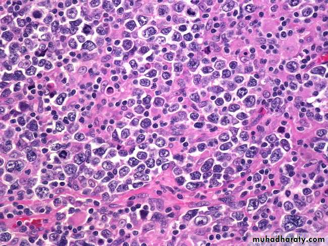 Lymph Node