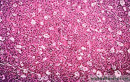 Lymph Node