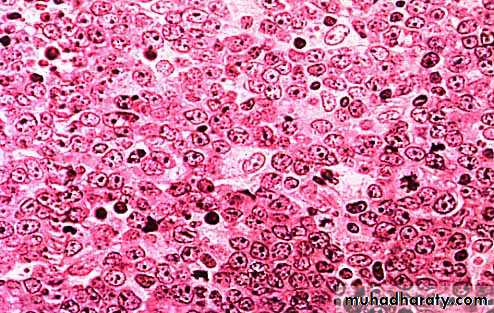 Lymph Node