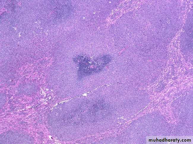 Lymph Node