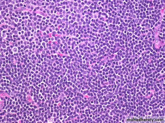 Lymph Node