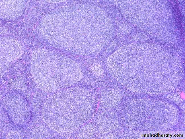 Lymph Node