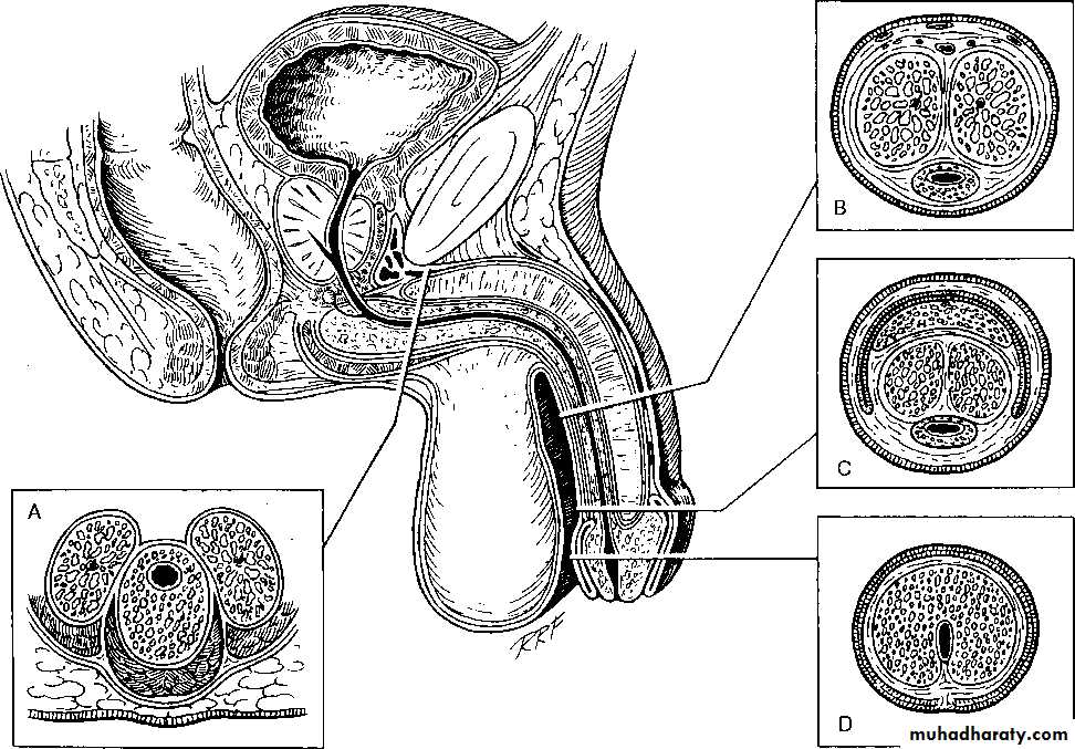 Urethra inury and hypospadias final