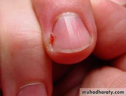 NailDiseases