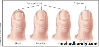 NailDiseases