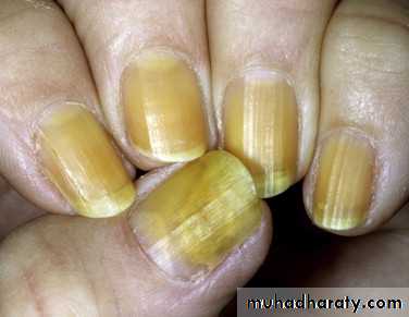 NailDiseases