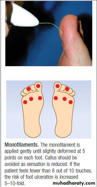 Diabetes Mellitus