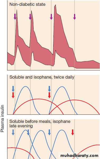 Diabetes Mellitus